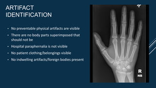 ARTIFACT
IDENTIFICATION
• No preventable physical artifacts are visible
• There are no body parts superimposed that
should not be
• Hospital paraphernalia is not visible
• No patient clothing/belongings visible
• No indwelling artifacts/foreign bodies present
R
NB
 