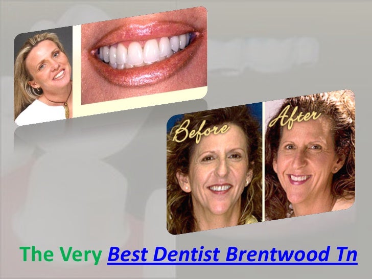 Brentwood dentists