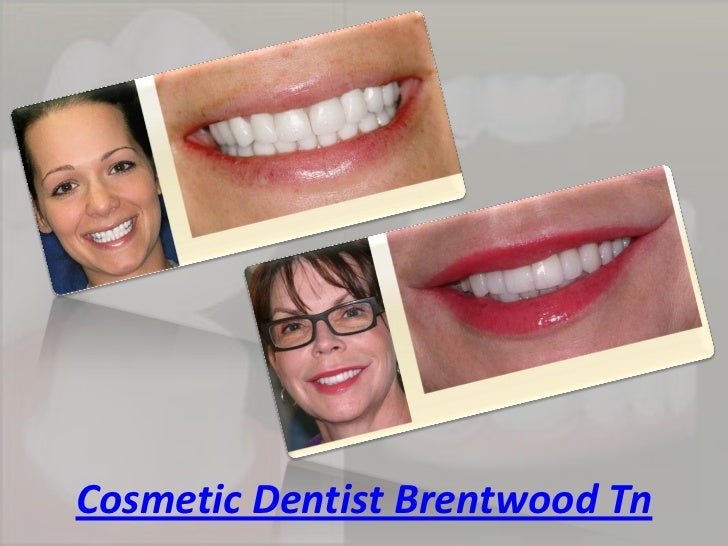 Brentwood dentists