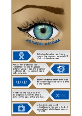 Retinoblastoma Facts 