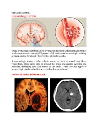 TYPES OF STROKE:
Hemorrhagic stroke
There are two typesof stroke, hemorrhagic and ischemic. Hemorrhagicstrokes
areless common,infact only15percentof allstrokesarehemorrhagic, butthey
are responsible for about 40 percent of all stroke deaths.
A hemorrhagic stroke is either a brain aneurism burst or a weakened blood
vessel leak. Blood spills into or around the brain and creates swelling and
pressure, damaging cells and tissue in the brain. There are two types of
hemorrhagic stroke called intracerebral and subarachnoid.
INTRACEREBRAL HEMORRHAGE
 