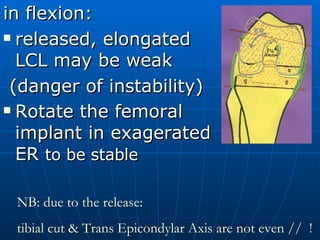 [object Object],[object Object],[object Object],[object Object],NB: due to the release: tibial cut & Trans Epicondylar Axis are not even //  ! 