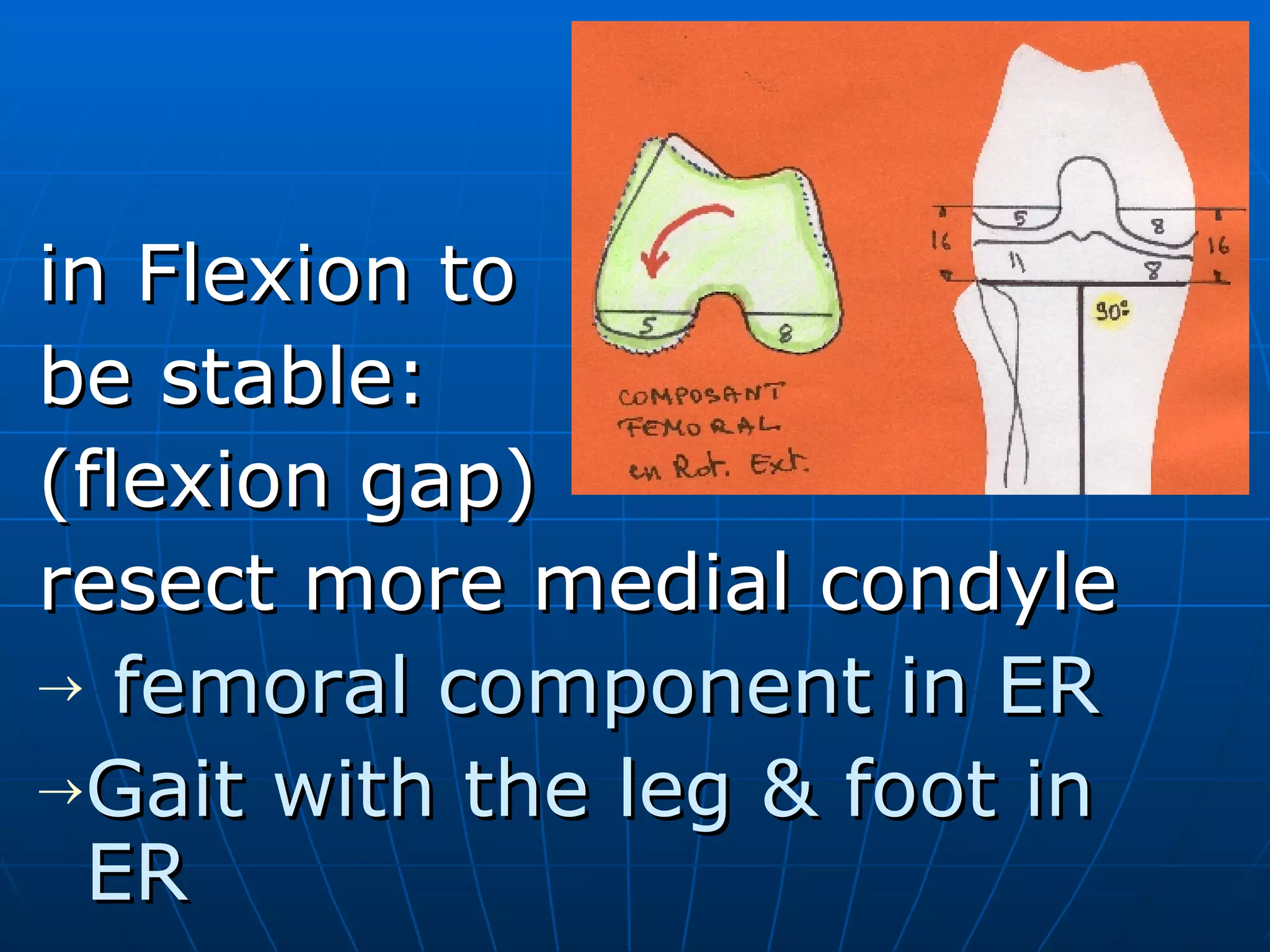 briard-jl-how-to-correct-extra-articular-deformity-slide-7-14-ppt
