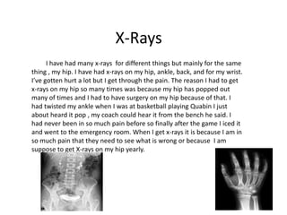 X-Rays
      I have had many x-rays for different things but mainly for the same
thing , my hip. I have had x-rays on my hip, ankle, back, and for my wrist.
I’ve gotten hurt a lot but I get through the pain. The reason I had to get
x-rays on my hip so many times was because my hip has popped out
many of times and I had to have surgery on my hip because of that. I
had twisted my ankle when I was at basketball playing Quabin I just
about heard it pop , my coach could hear it from the bench he said. I
had never been in so much pain before so finally after the game I iced it
and went to the emergency room. When I get x-rays it is because I am in
so much pain that they need to see what is wrong or because I am
suppose to get X-rays on my hip yearly.
 