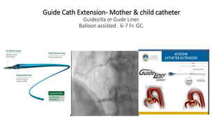 Difficulties in Transradial Intervention ( TRI). | PPTX