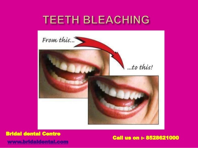 Bridal Dental Studio Bridal Dental Studio