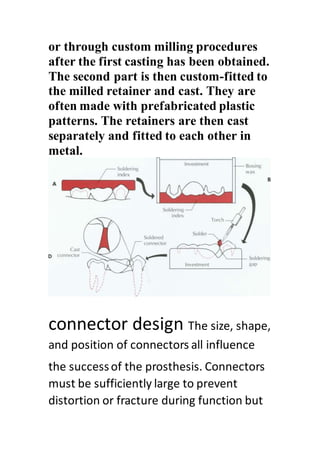 Tooth Connection Engineering different designs of dental bridges | DOCX