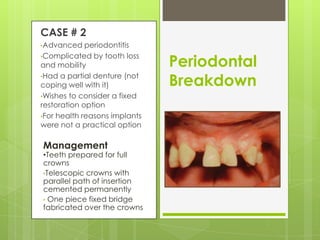 Periodontal
Breakdown
CASE # 2
•Advanced periodontitis
•Complicated by tooth loss
and mobility
•Had a partial denture (not
coping well with it)
•Wishes to consider a fixed
restoration option
•For health reasons implants
were not a practical option
Management
•Teeth prepared for full
crowns
•Telescopic crowns with
parallel path of insertion
cemented permanently
• One piece fixed bridge
fabricated over the crowns
 