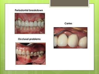 Periodontal breakdown




                        Caries




  Occlusal problems
 