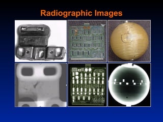 Radiographic Images
 