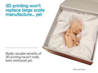 3D printing won’t
replace large scale
manufacture... yet
Really valuable benefits of
3D printing haven’t really
been embraced yet.
3D printed foetus
 