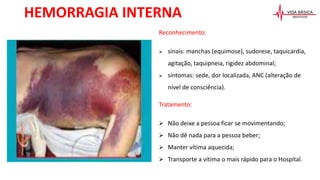 Reconhecimento:
 sinais: manchas (equimose), sudorese, taquicardia,
agitação, taquipneia, rigidez abdominal;
 sintomas: sede, dor localizada, ANC (alteração de
nível de consciência).
Tratamento:
 Não deixe a pessoa ficar se movimentando;
 Não dê nada para a pessoa beber;
 Manter vítima aquecida;
 Transporte a vítima o mais rápido para o Hospital.
HEMORRAGIA INTERNA
 