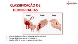  Arterial: Saída intermitente, sangue vermelho brilhante.
 Venosa: Saída continua, vermelho escuro.
 Capilar: Saída de sangue em pequena quantidade.
CLASSIFICAÇÃO DE
HEMORRAGIAS
 