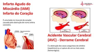 Infarto Agudo do
Miocárdio (IAM)
Infarto do Coração
É uma lesão no musculo do coração
causada pela obstrução de numa artéria
coronária.
Acidente Vascular Cerebral
(AVC) - Derrame Cerebral
É a obstrução dos vasos sanguíneos do cérebro
(isquêmico) ou a ruptura de um ou mais vasos
(hemorrágico).
 