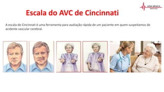 Escala do AVC de Cincinnati
A escala de Cincinnati é uma ferramenta para avaliação rápida de um paciente em quem suspeitamos de
acidente vascular cerebral.
 