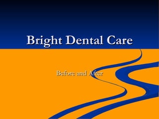 Bright Dental Care

     Before and After
 