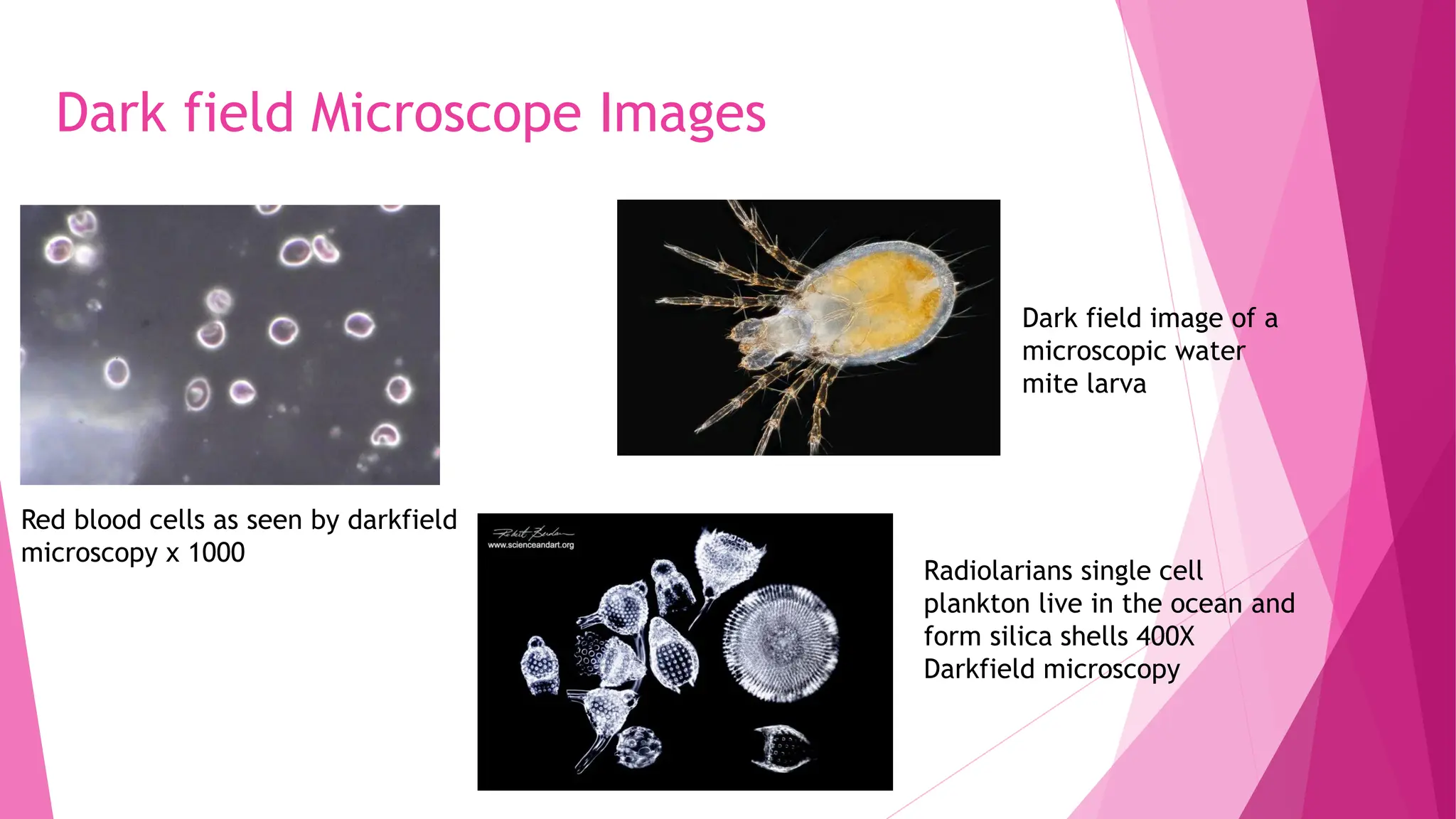 Dark field Microscope Images
Red blood cells as seen by darkfield
microscopy x 1000
Dark field image of a
microscopic water
mite larva
Radiolarians single cell
plankton live in the ocean and
form silica shells 400X
Darkfield microscopy
 