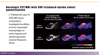 Oncologic PET/MRI with SUV (standard uptake value)
quantification
SimPET in Action
• [ 18F]FDG PET and T2
FSE MRI scans
conducted to
investigate the effects
of tumor associated
macrophages on
tumor hypoxia and
aerobic glycolysis
(Cancer Research,
2019)
 