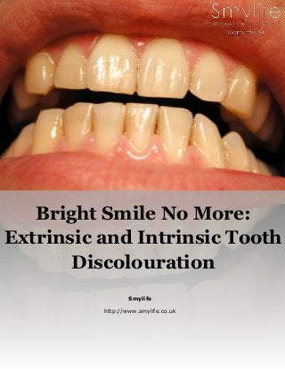 Smylife
http://www.smylife.co.uk
Bright Smile No More:
Extrinsic and Intrinsic Tooth
Discolouration
 