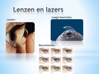 Lenzen:
Laagje hoornvlies:
Kleurenlenzen:
 