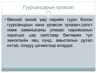 Гуурсанцарын үрэвсэл
 Өвчний эхний үед нарийн гуурс болон
гуурсанцрын хана үрэвсэн зузаарч,салст
хөөж хаваншсаны улмаас нарийсахын
зэрэгцээ цэр салстаар бөглөрөх тул
эмнэлзүйн явц хүнд, амьсгалын дутал
ихтэй, голдуу цочмогоор илэрдэг.
 
