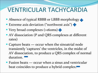 VENTRICULAR TACHYCARDIA Absence of typical RBBB or LBBB morphology Extreme axis deviation (“northwest axis”) Very broad complexes (>160ms) AV dissociation (P and QRS complexes at different rates) Capture beats — occur when the sinoatrial node transiently ‘captures’ the ventricles, in the midst of AV dissociation, to produce a QRS complex of normal duration. Fusion beats — occur when a sinus and ventricular beat coincides to produce a hybrid complex. 