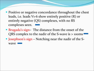 Positive or negative concordance throughout the chest leads, i.e. leads V1-6 show entirely positive (R) or entirely negative (QS) complexes, with no RS complexes seen. Brugada’s sign –  The distance from the onset of the QRS complex to the nadir of the S-wave is > 100ms Josephson’s sign  – Notching near the nadir of the S-wave 