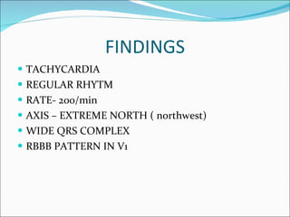 FINDINGS TACHYCARDIA REGULAR RHYTM RATE- 200/min AXIS – EXTREME NORTH ( northwest) WIDE QRS COMPLEX  RBBB PATTERN IN V1  