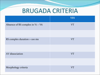 BRUGADA CRITERIA YES Absence of RS complex in V1 – V6 VT RS complex duration > 100 ms VT AV dissociation  VT Morphology criteria VT 