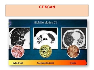 CT SCAN
 