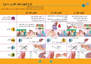 26
‫هي؟‬ ‫ما‬ ،‫األخرى‬ ‫الكبد‬ ‫التهاب‬ ‫أنواع‬
ً‫ا‬‫خطر‬ ّ‫ل‬‫أق‬ ‫أنها‬ ‫كما‬ ‫الحدوث‬ ‫نادرة‬ ‫هي‬
‫المرض‬ ‫تعقيدات‬ ‫من‬ ‫يزيد‬ ‫مما‬ ،‫مختلف‬ ‫كبد‬ ‫التهاب‬ ‫من‬ ‫بأكثر‬ ‫الوقت‬ ‫نفس‬ ‫في‬ ‫نصاب‬ ‫أن‬ ‫يمكن‬
‫وعدد‬ ‫االنتشار‬
‫العالم‬ ‫في‬ ‫الوفيات‬
‫ألف‬ ‫الكبد‬ ‫التهاب‬
‫العام‬ ‫في‬ ‫حالة‬ ‫مليون‬ 1.4
‫العام‬ ‫في‬ ‫وفاة‬ ‫آالف‬ ‫سبعة‬
‫فرنسا‬ ‫في‬ ‫الحدوث‬ ‫نادر‬
‫العدوى‬
‫التطور‬
‫عالج‬
‫وقاية‬
‫آلوده‬ ‫غذائ‬ ‫و‬ ‫آب‬ ‫خصوص‬ ‫به‬
)‫آب‬ ‫بودئ‬ ‫(نا‬ ‫نجاست‬ ‫مواد‬ ‫با‬
% 99 :‫تلقائي‬ ‫شفاء‬
% 1 ‫خاطف‬ ‫التهاب‬
27
‫دال‬ ‫الكبد‬ ‫التهاب‬ ‫إي‬ ‫الكبد‬ ‫التهاب‬
‫بالتهاب‬ ‫اإلصابة‬ ‫بعد‬ ‫أو‬ ‫الوقت‬ ‫نفس‬ ‫في‬ ‫به‬ ‫نصاب‬
‫ب‬ ‫الكبد‬
‫تكاثره‬ ‫أجل‬ ‫من‬ ‫ب‬ ‫الفيروس‬ ‫دال‬ ‫الفيروس‬ ‫يستعمل‬
‫المزمنة‬ ‫اإلصابة‬ ‫لديهم‬ ‫مالين‬ ‫عشرة‬
‫العام‬ ‫في‬ ‫حالة‬ ‫مليون‬ ‫عشرون‬
‫العام‬ ‫في‬ ‫وفاة‬ ‫ألف‬ ‫سبعون‬
‫فرنسا‬ ‫في‬ ً‫ا‬‫جد‬ ‫نادر‬
% 20 ‫شفاء‬
% 80 ‫مزمن‬ ‫التهاب‬
% 99 ‫شفاء‬
% 1 ‫خاطف‬ ‫التهاب‬
‫المصابة‬ ‫الغزالن‬ ‫أو‬ ‫الخنزير‬ ‫لحم‬ ‫خالل‬ ‫من‬
‫الملوثة‬ ‫األغذية‬ ‫أو‬ ‫المياه‬ ‫خالل‬ ‫من‬
 