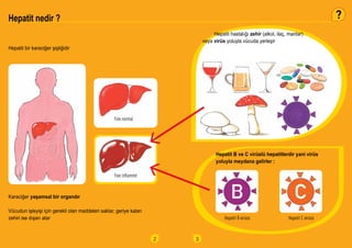 2
Hepatit bir karaciğer şişliğidir
Karaciğer yaşamsal bir organdır
Vücudun işleyişi için gerekli olan maddeleri saklar, ge...