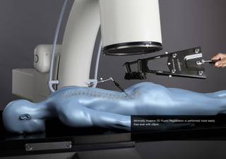 Minimally invasive 2D Fluoro Registration is performed more easily
than ever with xSpot.

 