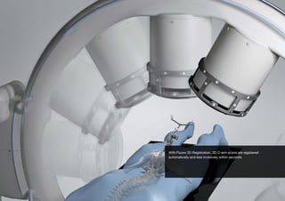 With Fluoro 3D Registration, 3D C-arm scans are registered
automatically and less invasively within seconds.

 