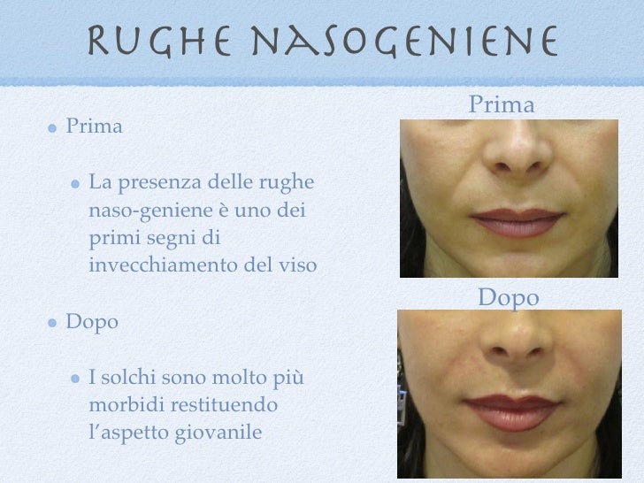 Get Rughe geniene Free HD Rughe Geniene