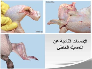 ‫عن‬ ‫الناتجة‬ ‫اإلصابات‬
‫الخاطئ‬ ‫التمسيك‬
228
 