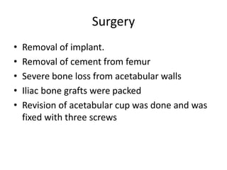 Surgery 
• Removal of implant. 
• Removal of cement from femur 
• Severe bone loss from acetabular walls 
• Iliac bone grafts were packed 
• Revision of acetabular cup was done and was 
fixed with three screws 
 