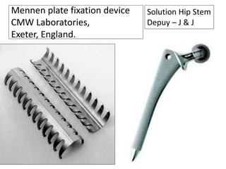 Mennen plate fixation device 
CMW Laboratories, 
Exeter, England. 
Solution Hip Stem 
Depuy – J & J 
 