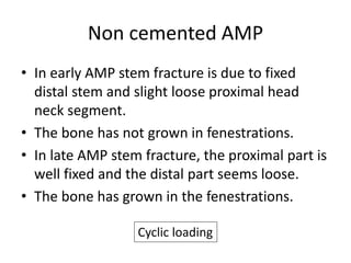 Non cemented AMP 
• In early AMP stem fracture is due to fixed 
distal stem and slight loose proximal head 
neck segment. 
• The bone has not grown in fenestrations. 
• In late AMP stem fracture, the proximal part is 
well fixed and the distal part seems loose. 
• The bone has grown in the fenestrations. 
Cyclic loading 
 