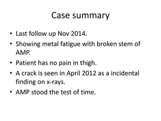 Case summary 
• Last follow up Nov 2014. 
• Showing metal fatigue with broken stem of 
AMP. 
• Patient has no pain in thigh. 
• A crack is seen in April 2012 as a incidental 
finding on x-rays. 
• AMP stood the test of time. 
 