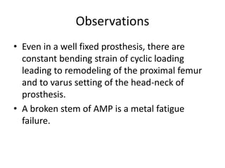 Observations
• Even in a well fixed prosthesis, there are
constant bending strain of cyclic loading
leading to remodeling of the proximal femur
and to varus setting of the head-neck of
prosthesis.
• A broken stem of AMP is a metal fatigue
failure.
 