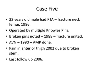 Case Five
• 22 years old male had RTA – fracture neck
femur. 1986
• Operated by multiple Knowles Pins.
• Broken pins noted – 1988 – fracture united.
• AVN – 1990 – AMP done.
• Pain in anterior thigh 2002 due to broken
stem.
• Last follow up 2006.
 