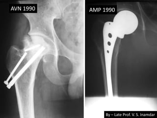 AVN 1990 AMP 1990
By – Late Prof. V. S. Inamdar
 