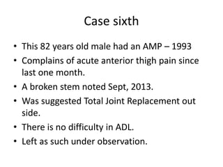 Case sixth
• This 82 years old male had an AMP – 1993
• Complains of acute anterior thigh pain since
last one month.
• A broken stem noted Sept, 2013.
• Was suggested Total Joint Replacement out
side.
• There is no difficulty in ADL.
• Left as such under observation.
 