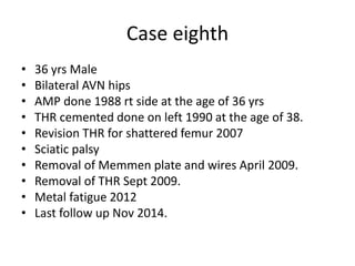 Case eighth
• 36 yrs Male
• Bilateral AVN hips
• AMP done 1988 rt side at the age of 36 yrs
• THR cemented done on left 1990 at the age of 38.
• Revision THR for shattered femur 2007
• Sciatic palsy
• Removal of Memmen plate and wires April 2009.
• Removal of THR Sept 2009.
• Metal fatigue 2012
• Last follow up Nov 2014.
 