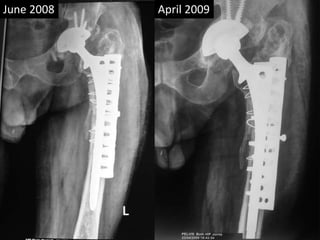 June 2008 April 2009
 