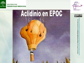 Aclidinio en EPOC por Carlos Fernández Oropesa se encuentra bajo una
Licencia Creative Commons Atribución-NoComercial-CompartirIgual 3.0 España.
 