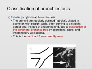 Bronchectasis and lung abcess c1.pptx