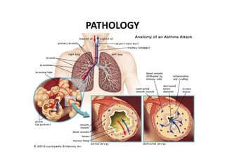 PATHOLOGY
 