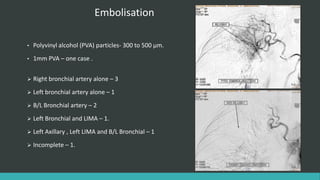 Pva Embolization Rmm Bronchial artery embolisation in haemoptysis | PPTX